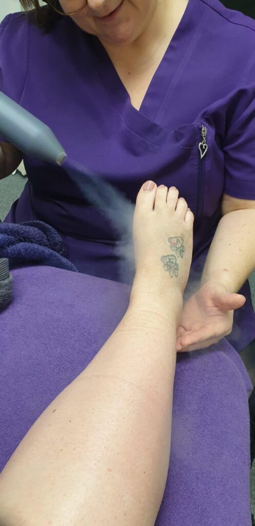 Foot treatment